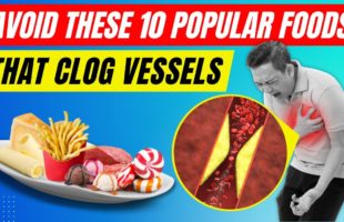 Top 10 Popular Foods That Clog Vessels To Avoid