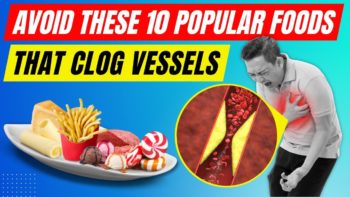 Top 10 Popular Foods That Clog Vessels To Avoid