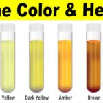 What The Color Of Your Urine Says About Your Health