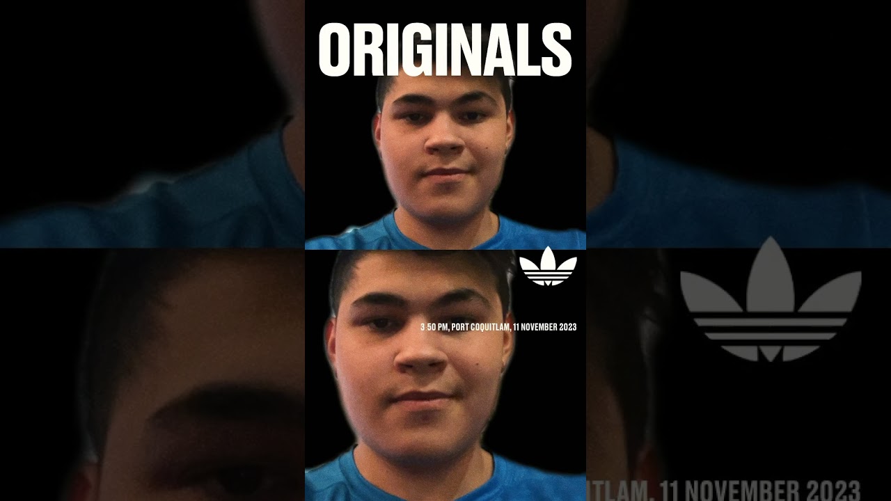 ￼ Adidas OriginalsCA #shorts