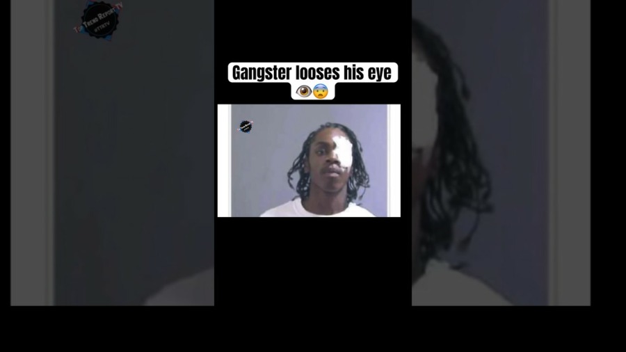 How Lil Les lost his eye 😨👁️ #chicago #gangmember #kingvon #ttrtv #gang